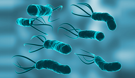 Can Helicobacter pylori on cutlery be killed by ultraviolet light?